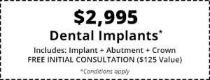 A coupon advertising a free initial consualtation and a $2,995 dental implant