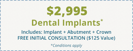 $2995 - Dental Implant coupon