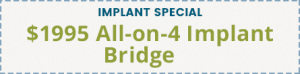 A coupon advertising a $1,995 all on 4 implant bridge