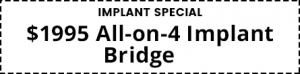 A coupon advertising a $1,995 all on 4 implant bridge