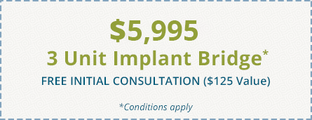 $5995 - 3 Unit Implant Bridge coupon