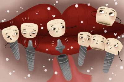 Cartoon showing happy dental implants ready to be inserted in the mouth.