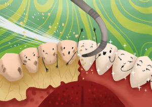 Cartoon image of a special dental tool removing plaque and tartar during a cleaning at the dentist in Grafton, MA