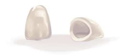 Illustration of 2 CEREC dental crowns against a white background