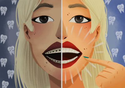 drawing of a woman before and after braces